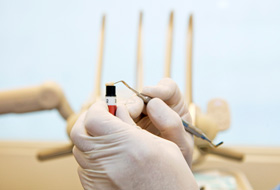 a dentist holding composite resin