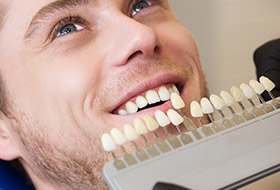 Man's smile compared with tooth color chart