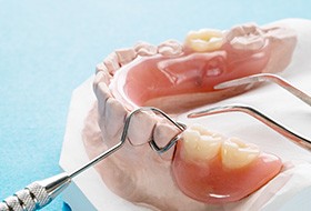 Implant dentures on model arch with dental instruments