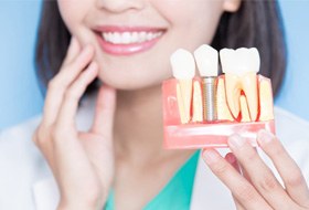 Woman holding model of dental implant