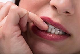 Closeup of patient biting their nails