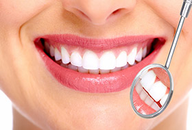 Woman with healthy teeth and gums