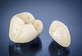 Two dental crowns prior to placement