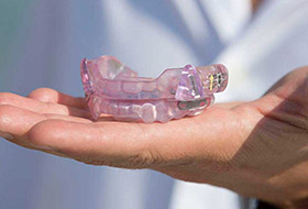 Hand holding an oral appliance