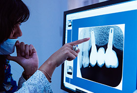 Dentist looking at digital x-rays