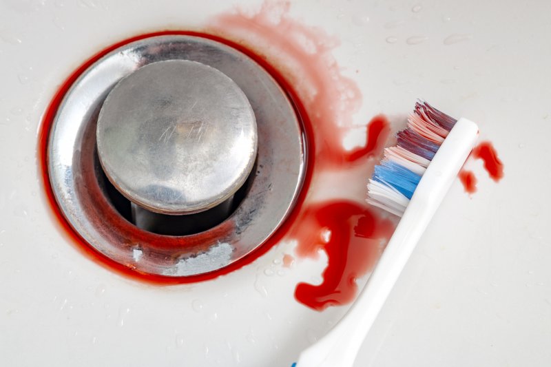 Blood on a toothbrush from gingivitis