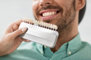 Man comparing shades of teeth whitening.